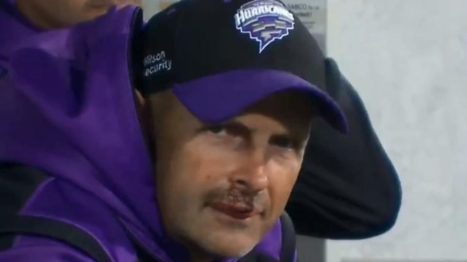 Kirsten suffers cracked jaw, loses multiple teeth in a training mishap