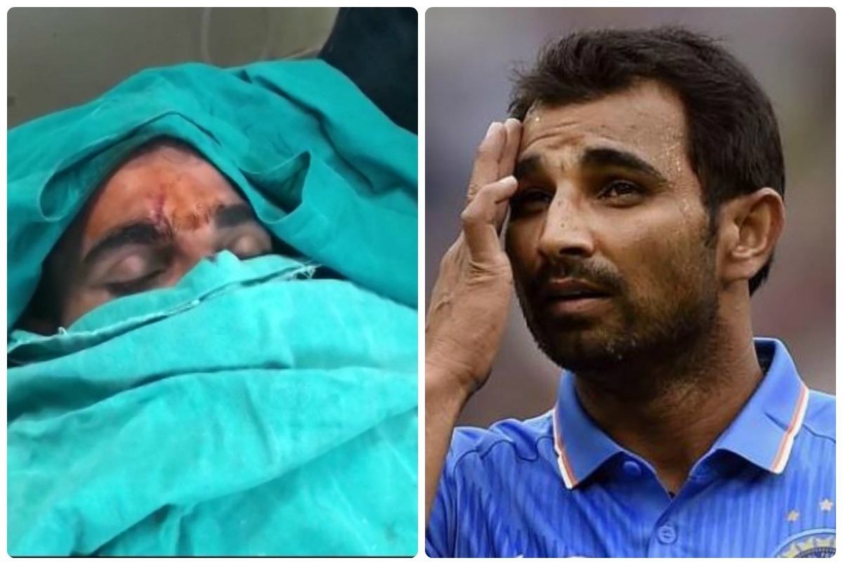 mohammed shami injured in road accident receives stitches Mohammed Shami injured in road accident, receives stitches