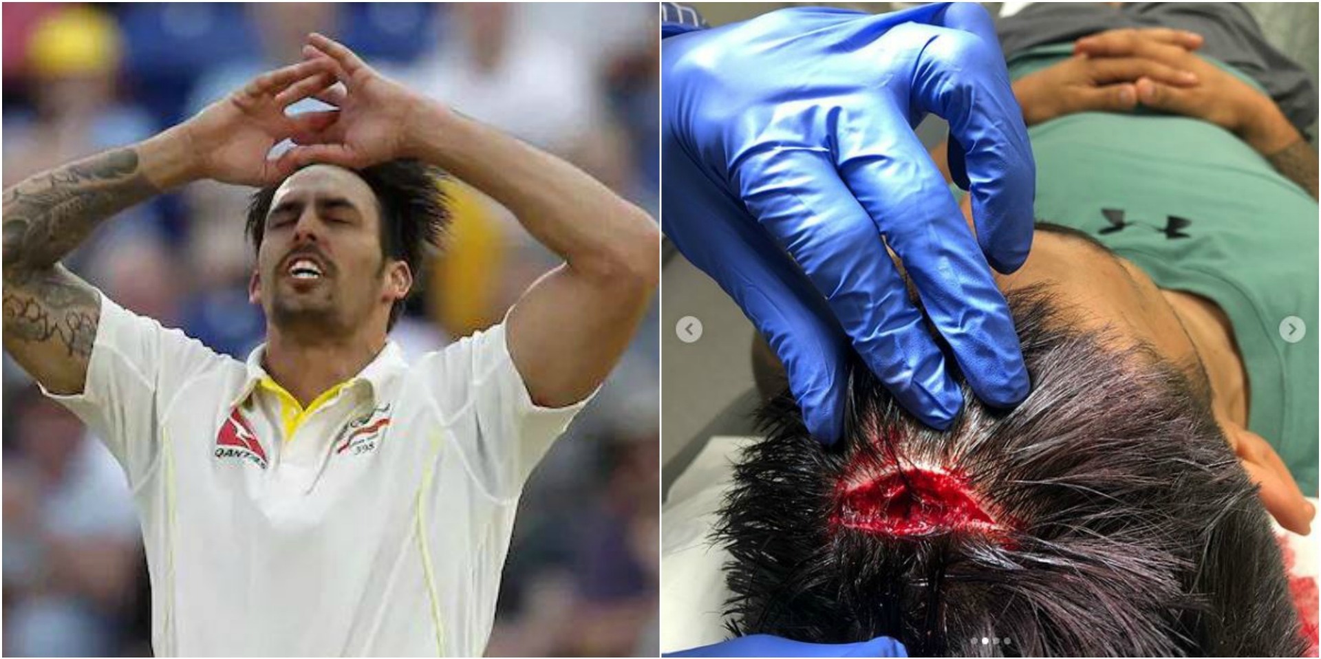 Johnson's horrific head injury gives KKR a scare