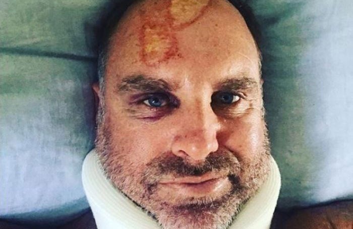 matthew hayden suffers head and spine injuries in accident Matthew Hayden suffers head and spine injuries in surf accident