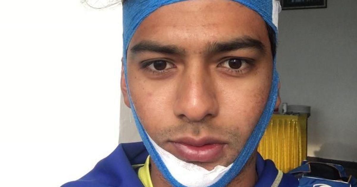 टूटे जबड़े के साथ मैदान पर उतरे उन्मुक्त, शतकीय पारी खेल टीम को दिलाई जीत