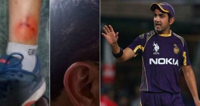 gambhir recommends ban for the cricketer responsible behind the attack on amit bhandari अमित भंडारी पर हुए हमले के बाद भड़के गौतम गंभीर, आरोपी खिलाड़ी के लिए की लाइफ टाइम बैन की मांग